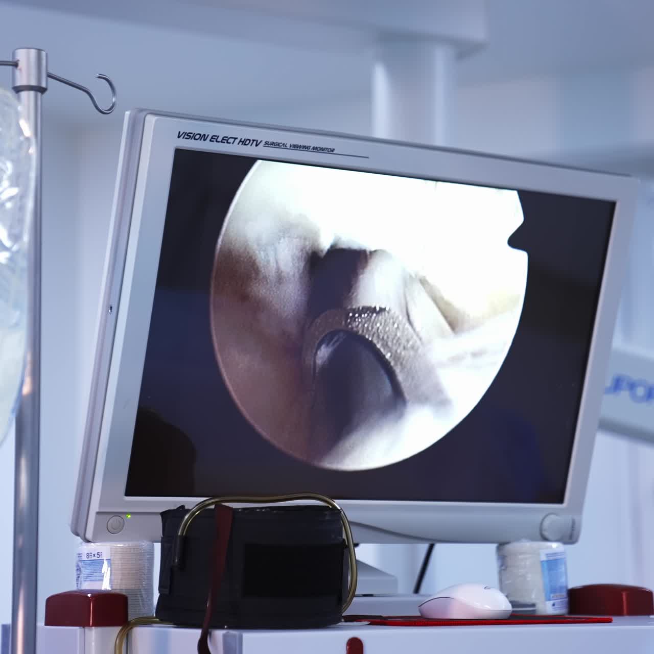 Laparoscopy procedure in hospital