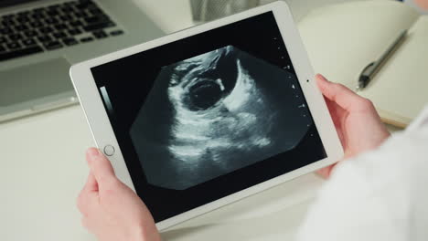 ultrasound image on tablet