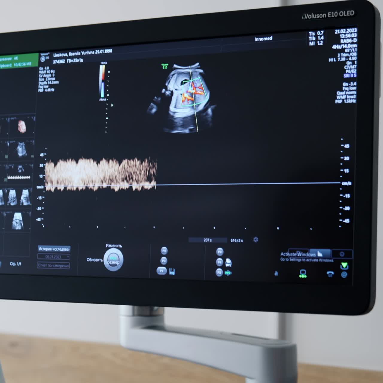 Monitor of ultrasound machine during the pregnancy check up. Close up. Examining the fetus development in hospital