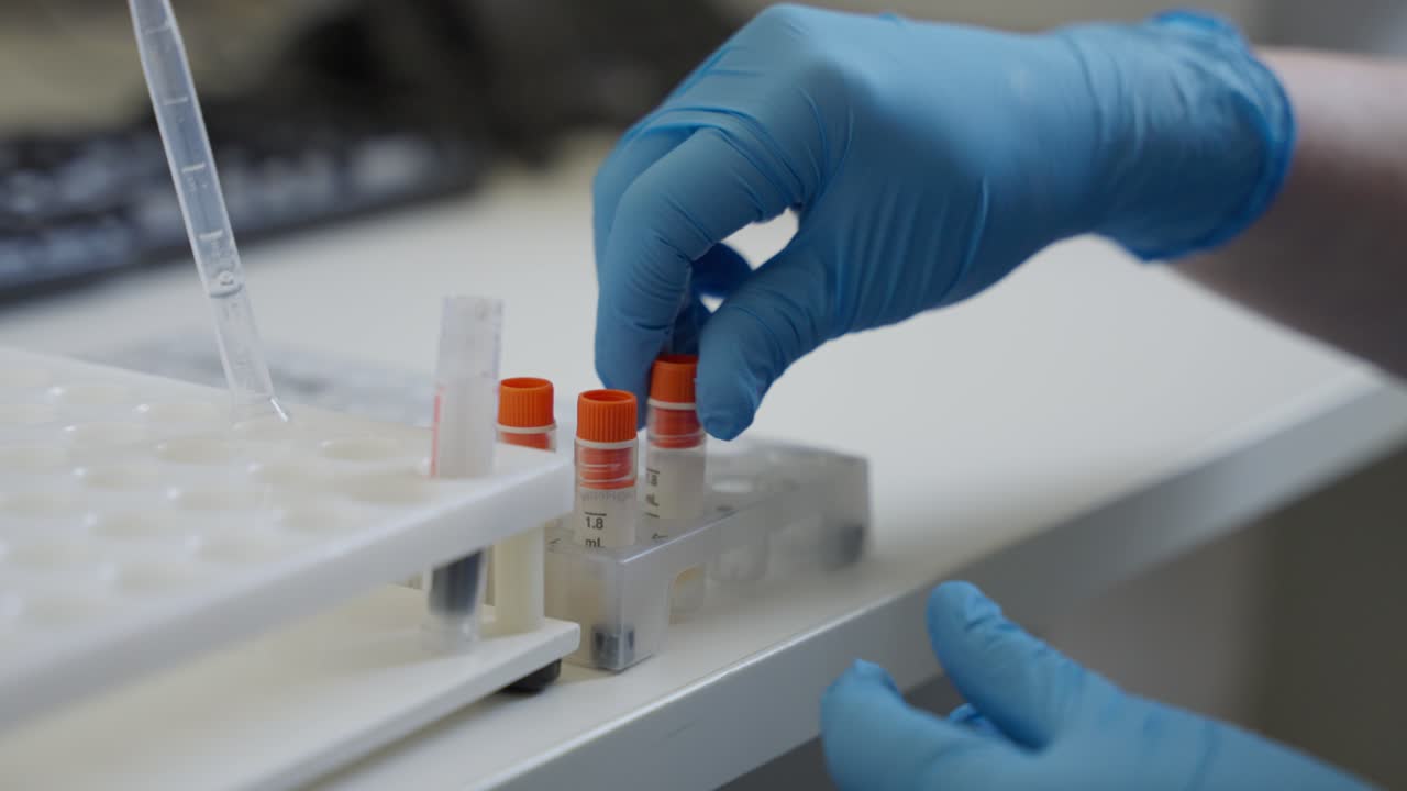 examinar una muestra de sangre en un laboratorio