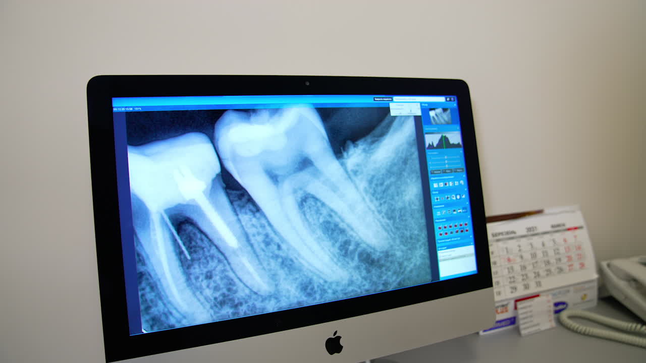 Dentist looks on the x-ray of a tooth. Monitor showing the photo of teeth in dental office. Oral hygiene, medical clinic.