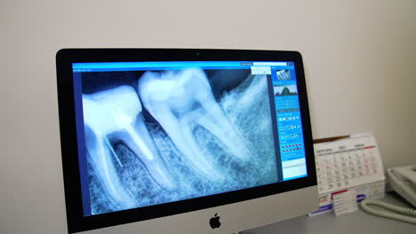 dentist looks on the x-ray of a tooth. monitor showing the photo of teeth in dental office. oral hygiene, medical clinic.