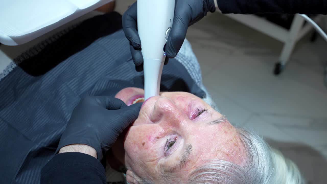 3D Dental Scanning of Elderly Patient