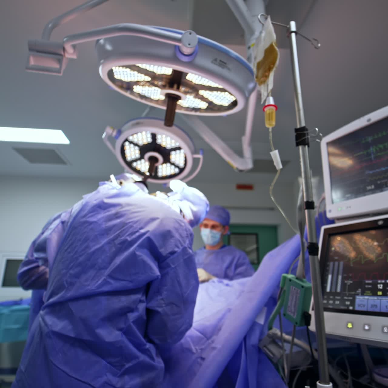 Medical equipment in modern surgery room working during the surgery. Monitors of lung ventilating machine showing life signs of a patient at operation