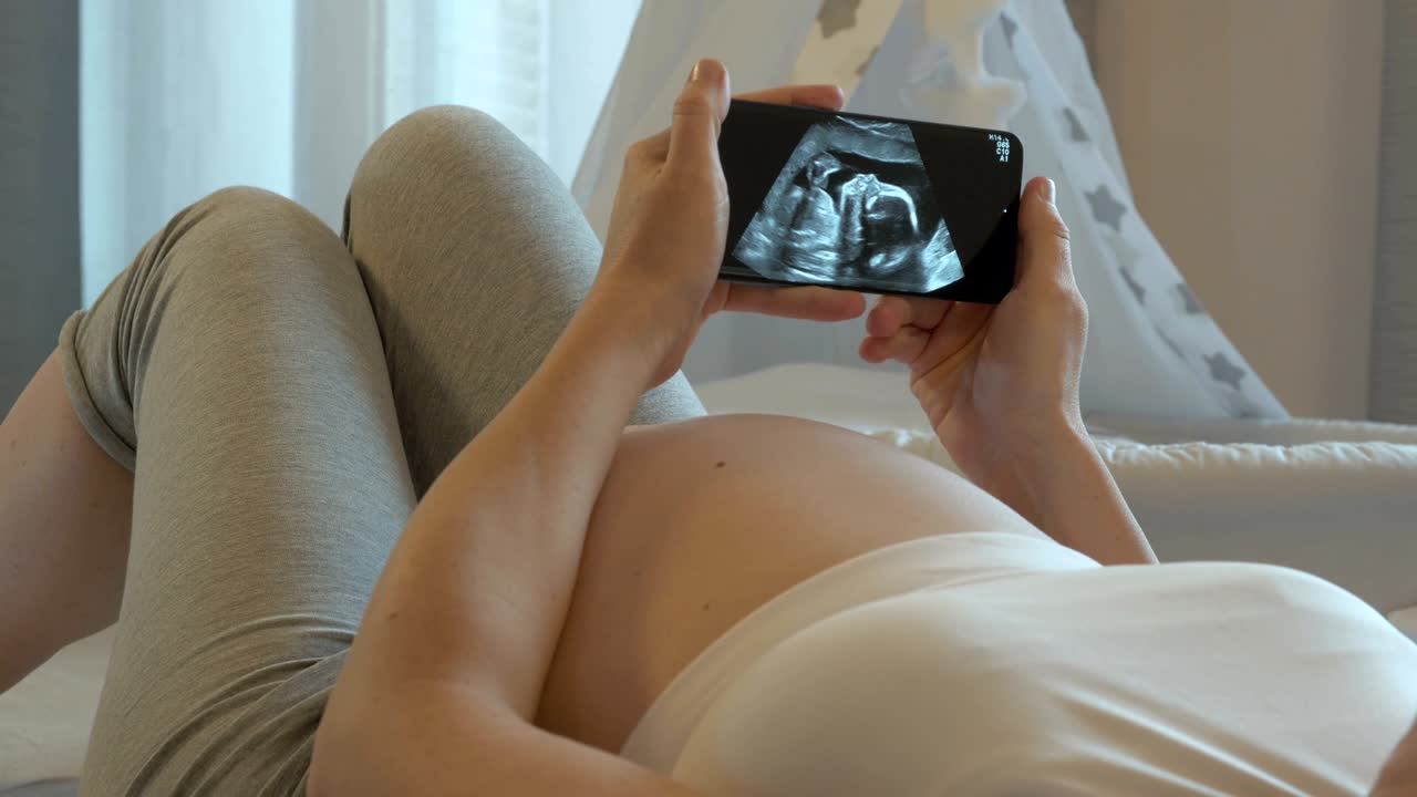 Ecografia nelle mani di una futura mamma.