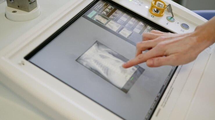 Médecin examinant la radiographie thoracique d'un enfant