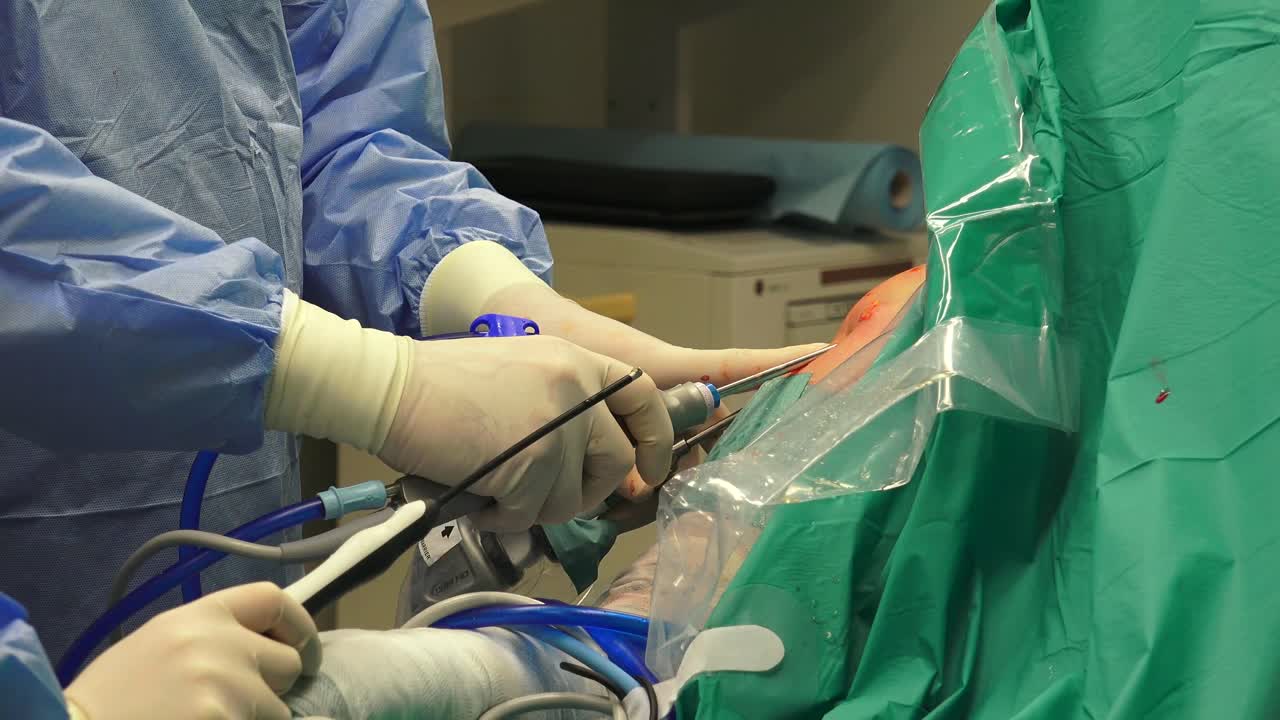 la cirugía del hombro es un medio para tratar los hombros lesionados