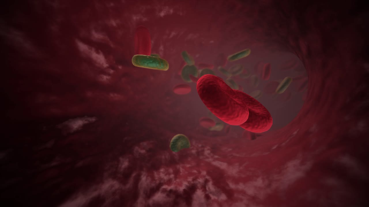 Infected Blood Vessel