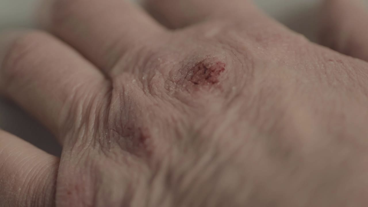Sore painful dry hands and skin macro isolated shot
