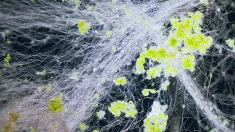 Microorganisms-ciliates-and-algae-high-concentration-microscopic-dark-field-view