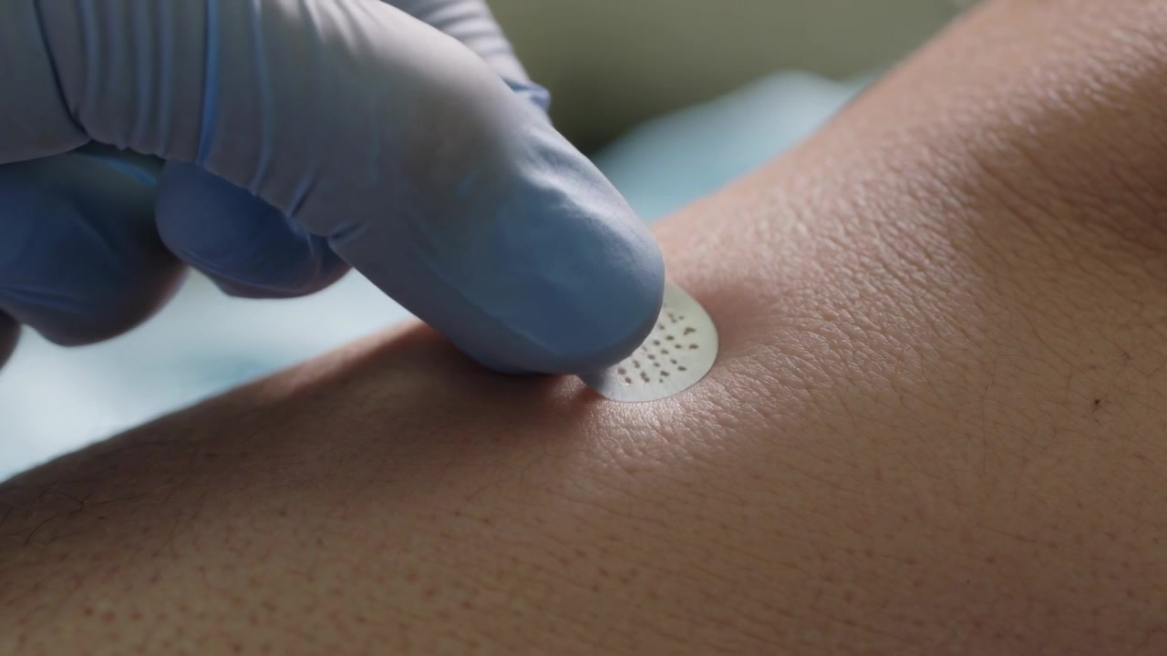Mani con guanti blu che allineano, posizionano e levigano una patch perforata sull'avambraccio in clinica per il monitoraggio.