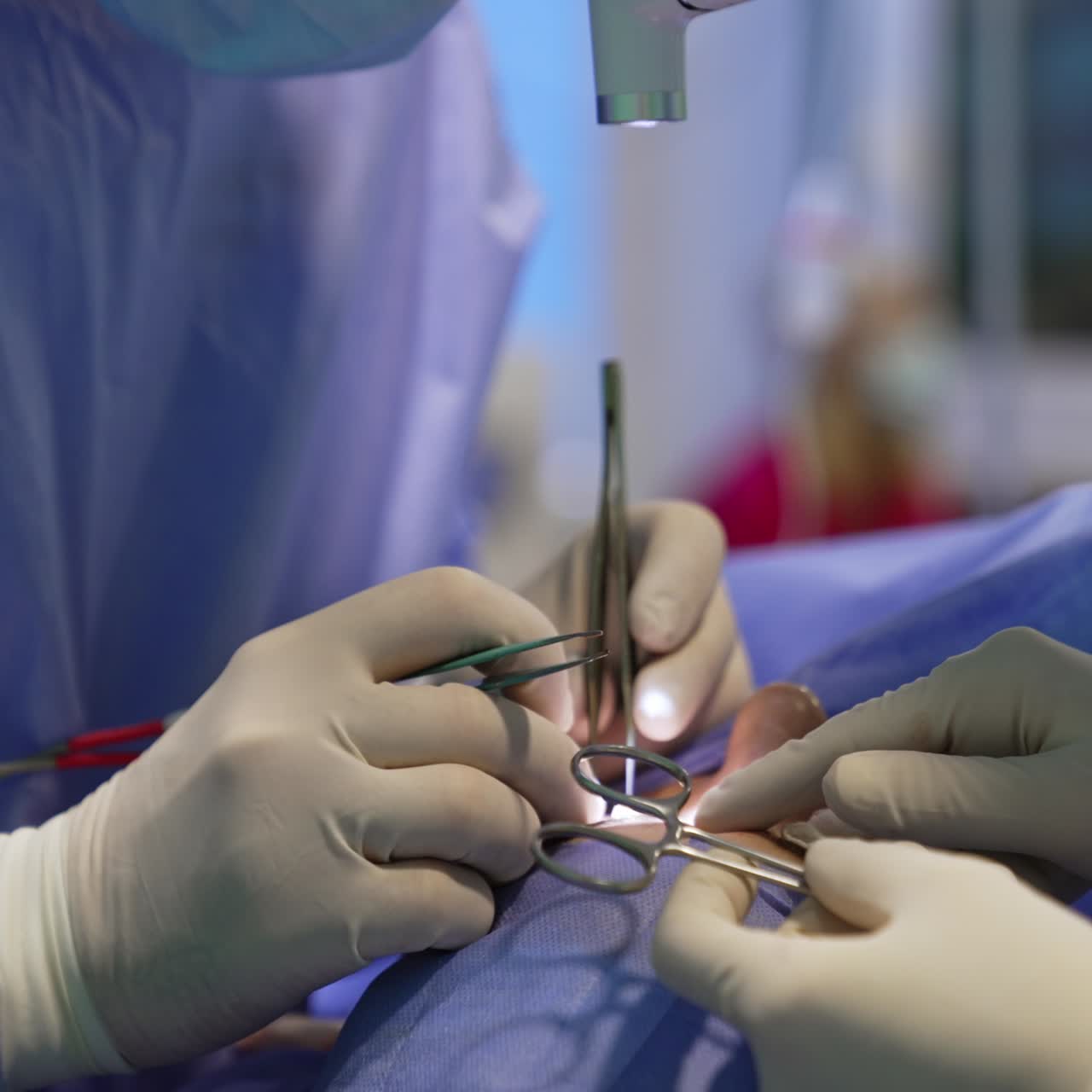 Gloved hands of surgeons carry out the blepharoplastic operation. Chief doctor uses modern device and assistant prepares tools. Close up