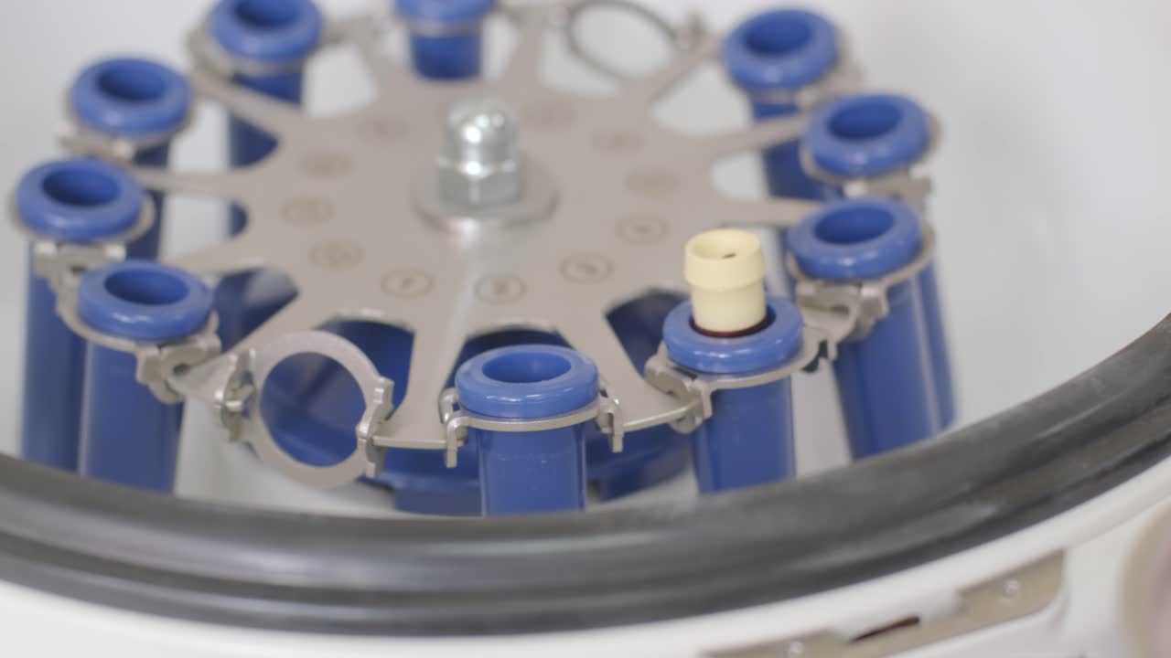 preparación de plasma rico en plaquetas. tubo con sangre en las manos. centrifugadora.