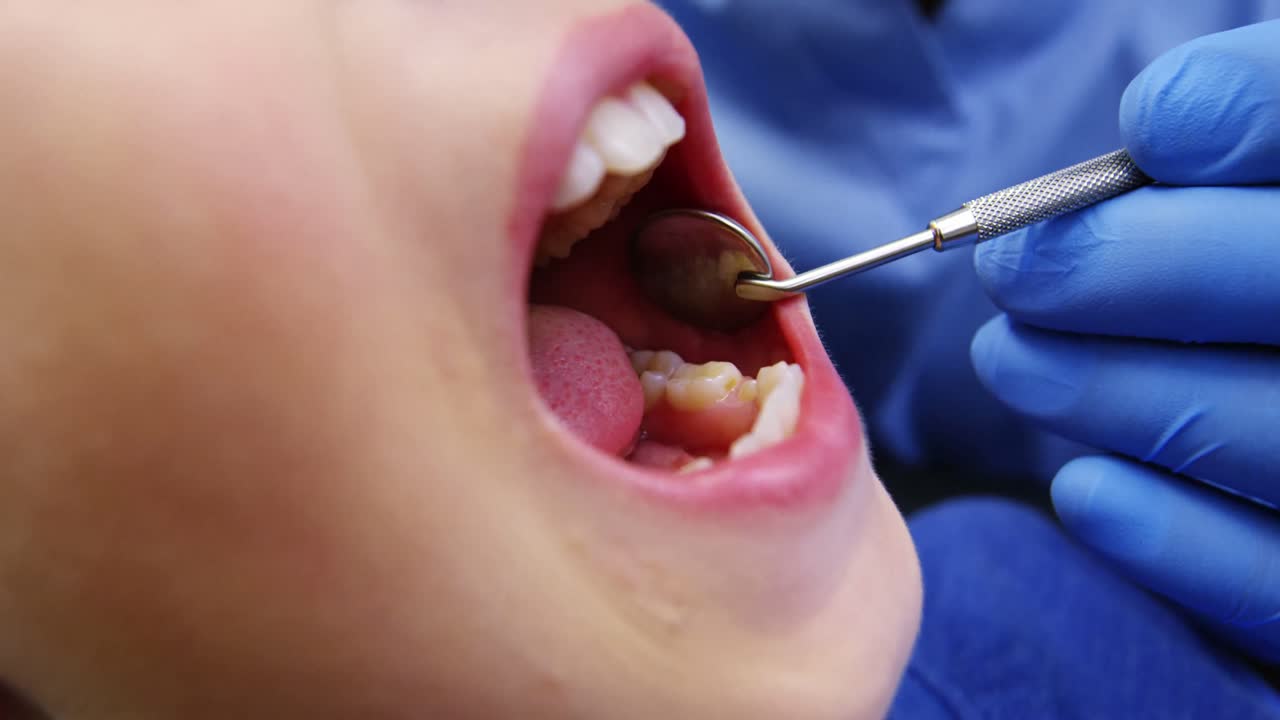 dentista examinando a un paciente joven con herramientas