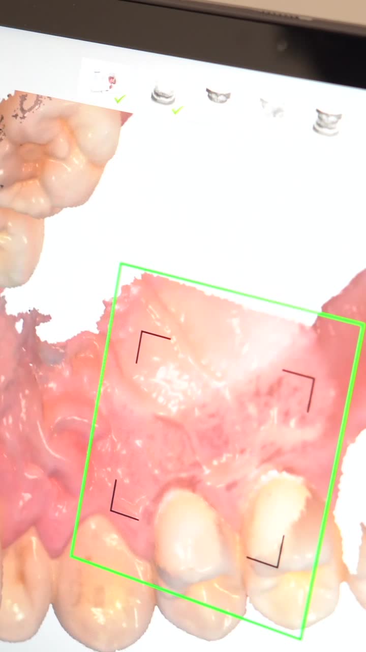 Dental scan of teeth and gums