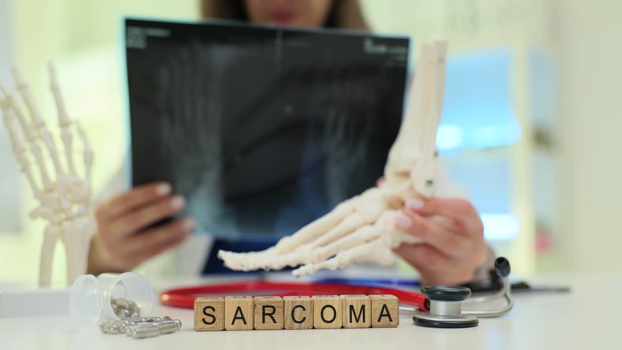 Wooden blocks spell sarcoma near bone xray analysis by doctor