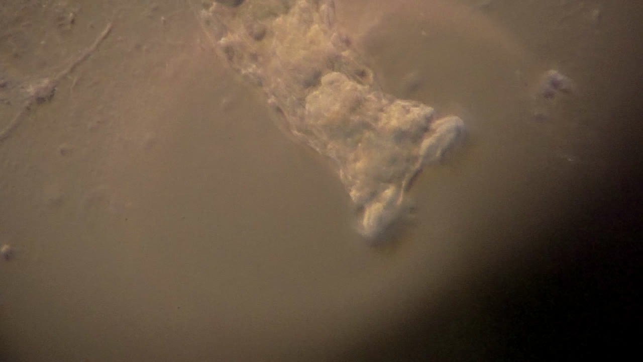 미세한 로티퍼가 먹이를 먹고 이동합니다.