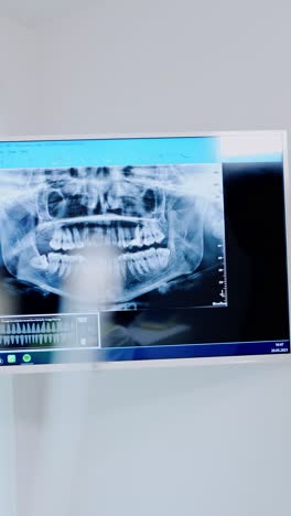 modern dental clinic scene with x-ray image shown on screen in vertical shot