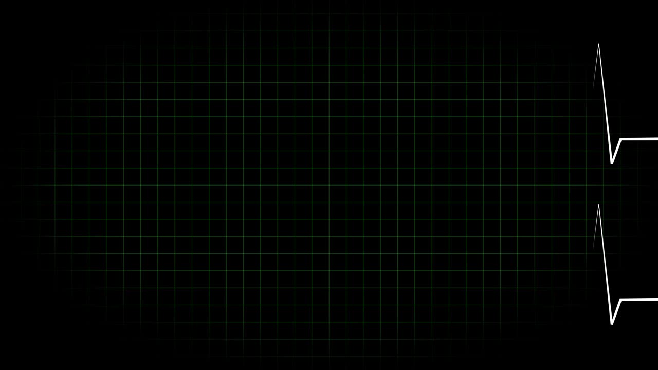 전기 심장 기록 오실로스코프 파동 형태 애니메이션 모션 그래픽