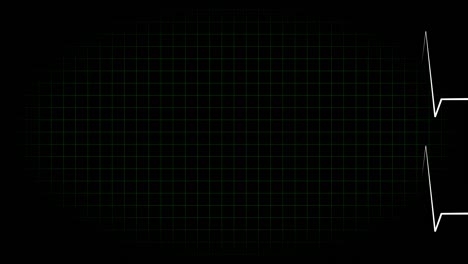 electrocardiograma osciloscopio forma de onda animación gráficos de movimiento