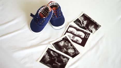 baby shoes and ultrasound photo. concept of waiting for the birth of a baby