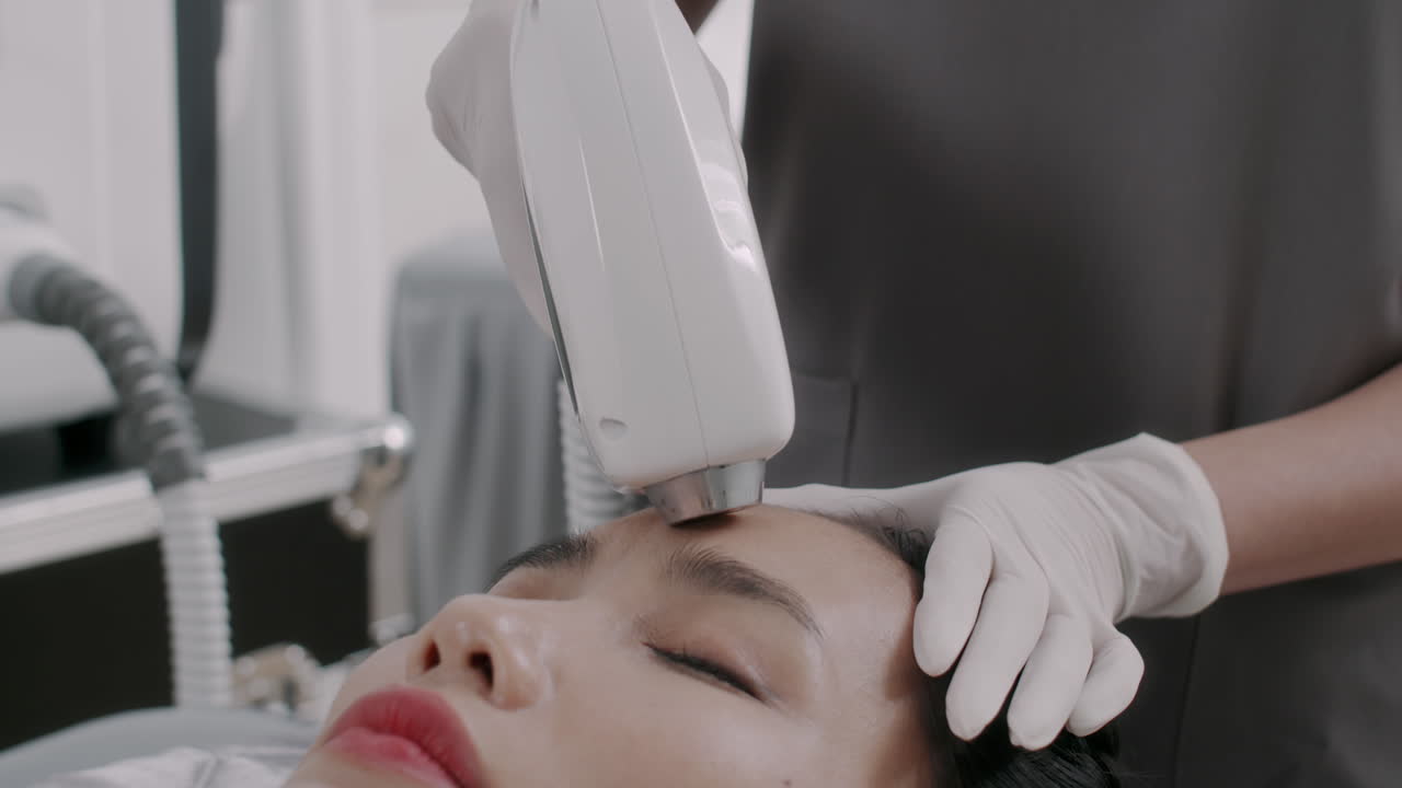Asian Woman Getting Rejuvenation Laser Treatment on Forehead
