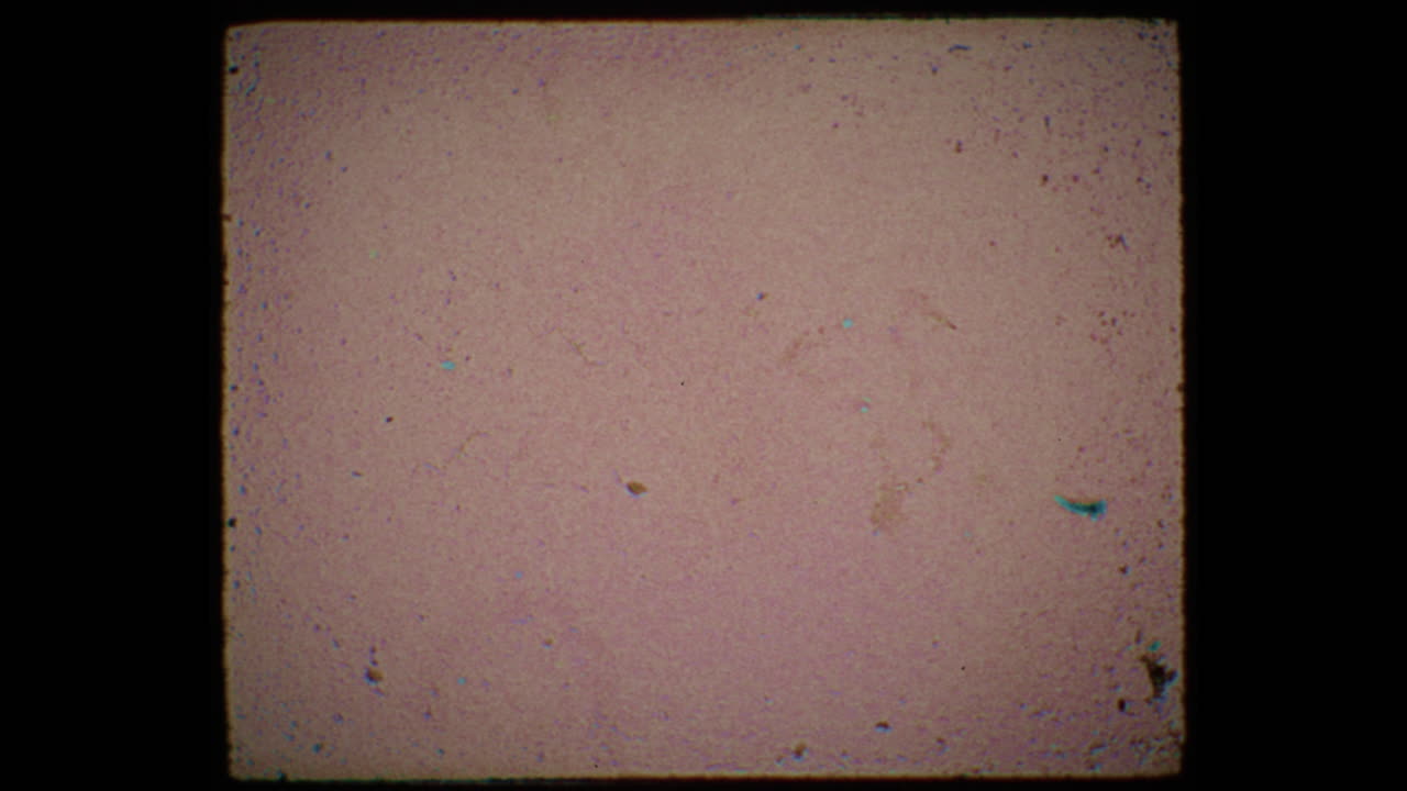 Damaged Old Film Frame