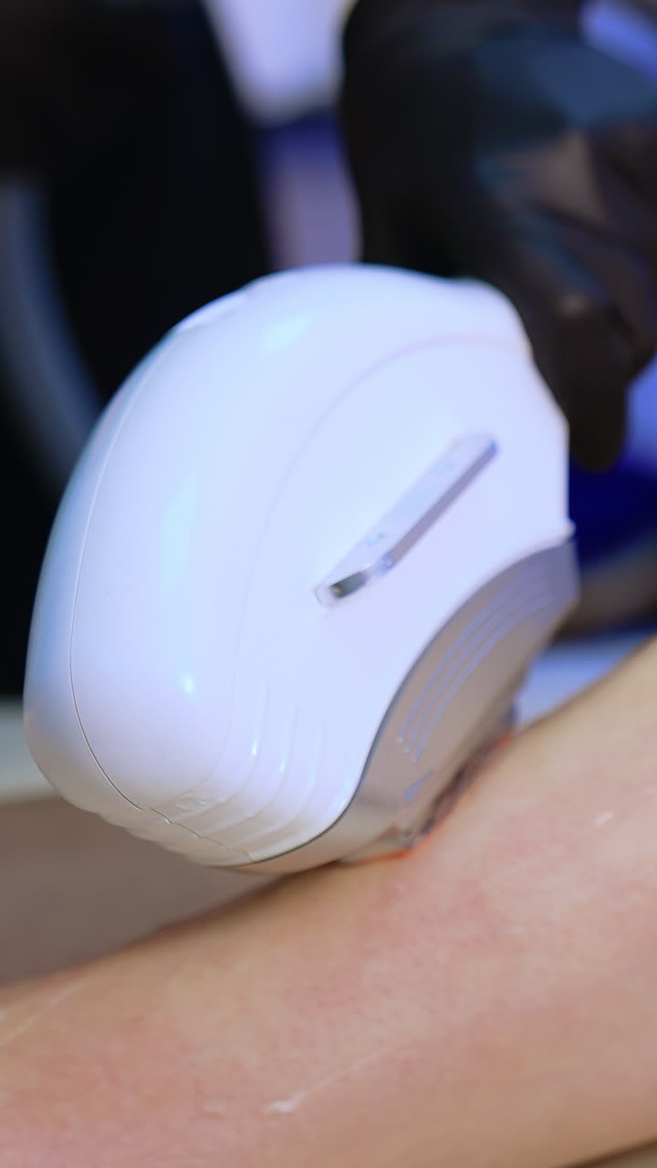 The procedure of hair removal on beautiful female legs. Beautician slowly moves the laser apparatus by the skin. Close up. Vertical video
