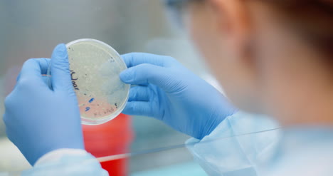 scientist looking at bacteries in petri dish at laboratory 2