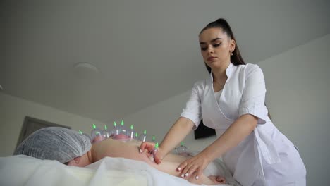 vacuum massage. vacuum cups of medical cupping therapy on woman back, close up, chinese medicine. high quality 4k footage