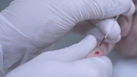 Recogida-De-Muestra-De-Sangre.-Extracción-De-Sangre-Para-La-Prueba-Del-Vih.-Análisis-De-Sangre-En-Los-Dedos