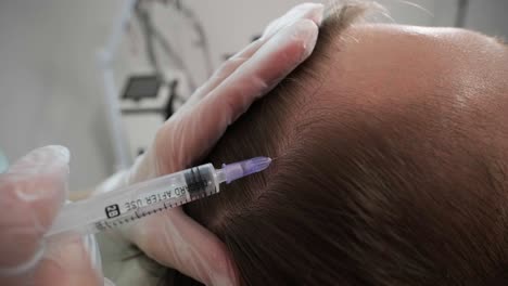 hair mesotherapy procedure in the modern cosmetology clinic. trichologist makes injections in the man’s scalp for hair growth and to prevent baldness