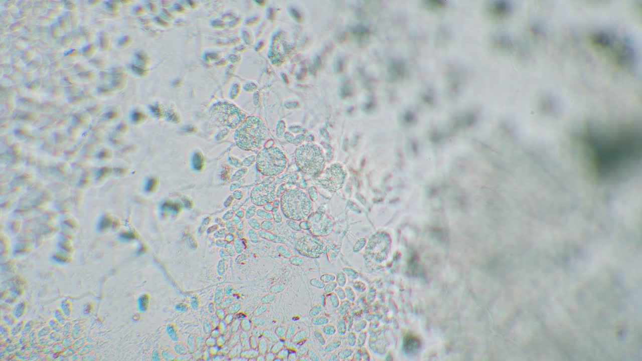 Freshly hatched germinated slime mold spores to amoeba between other spores