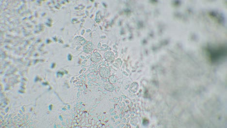 freshly hatched germinated slime mold spores to amoeba between other spores