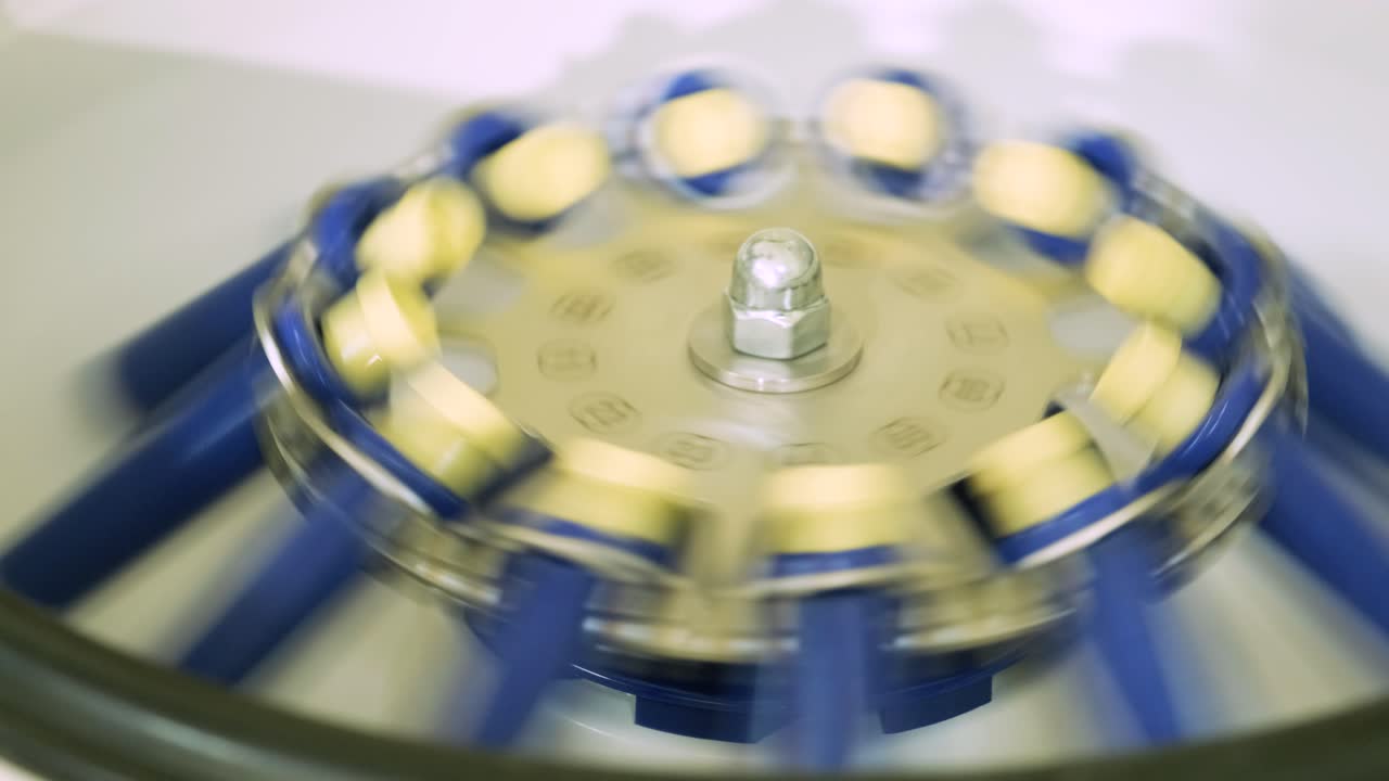 혈소판이 풍부한 플라즈마 준비: 손에 혈액을 가진 튜브, 원심분리기