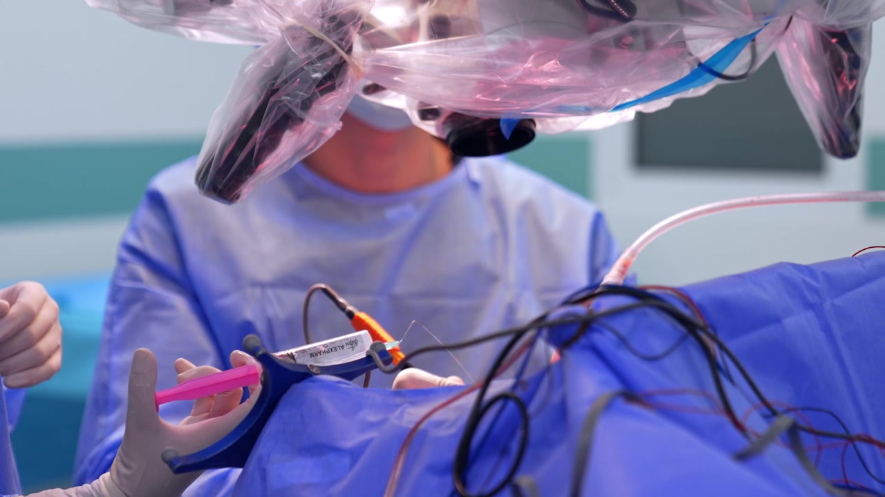 Médicos no identificados realizan neurocirugía usando un microscopio. Mano con guante de látex rocía medicamento de la jeringa