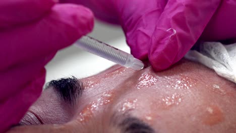 a woman getting botox injections on her face - close up detail