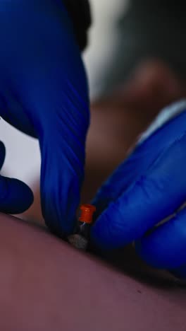 Vertical-video-Close-up-with-confident-movements,-a-medic-in-blue-gloves-grasps-the-needle-that-he-inserted-into-the-chest-and-stabilizes-it-with-the-help-of-special-tape-while-providing-first-aid-in-extreme-conditions