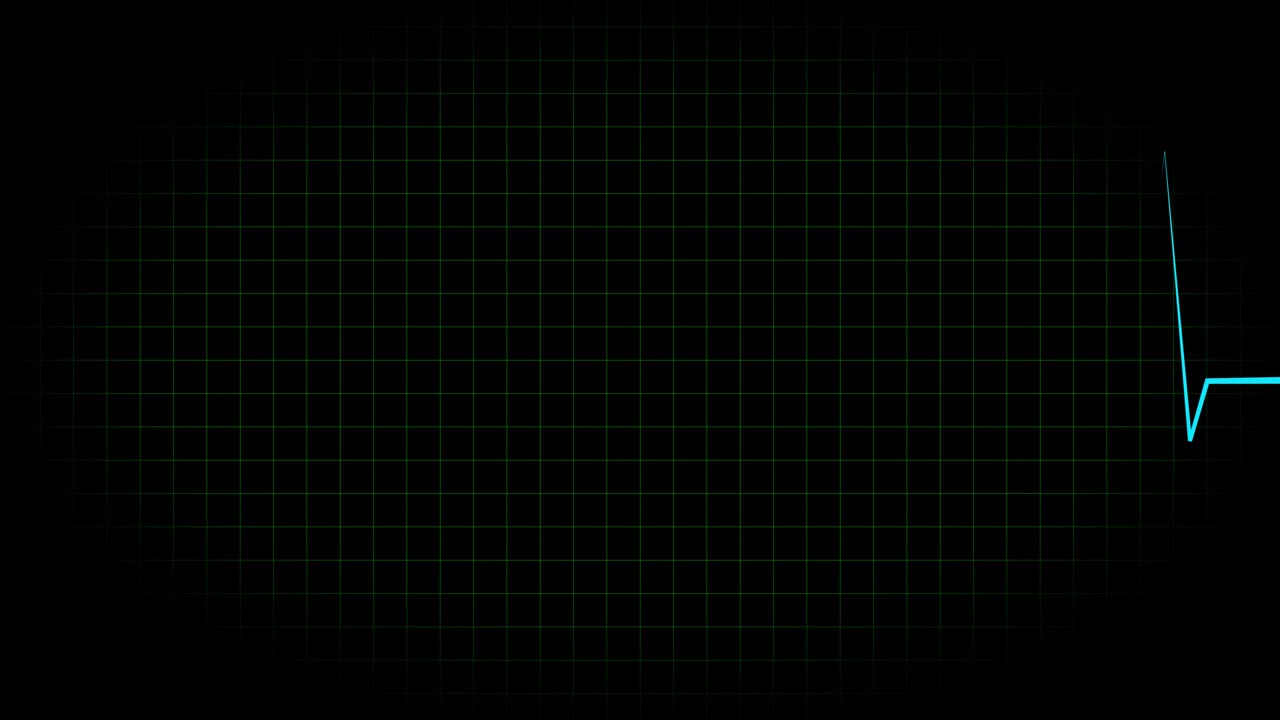 전기 심장 기록 오실로스코프 파동 형태 애니메이션 모션 그래픽