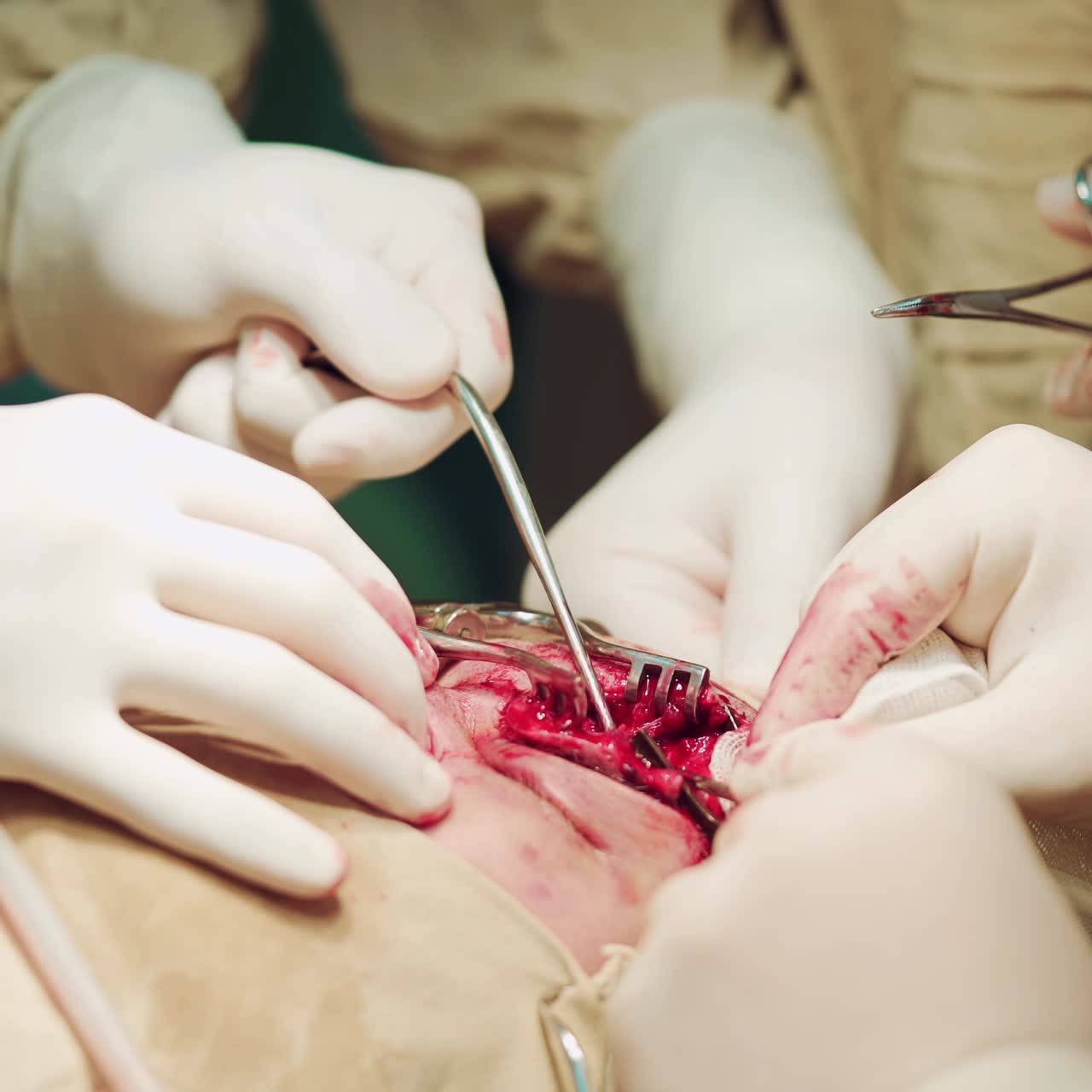 Close-up of the Surgeon's Hands and Instruments in the background of the Skull. Working with surgical instruments