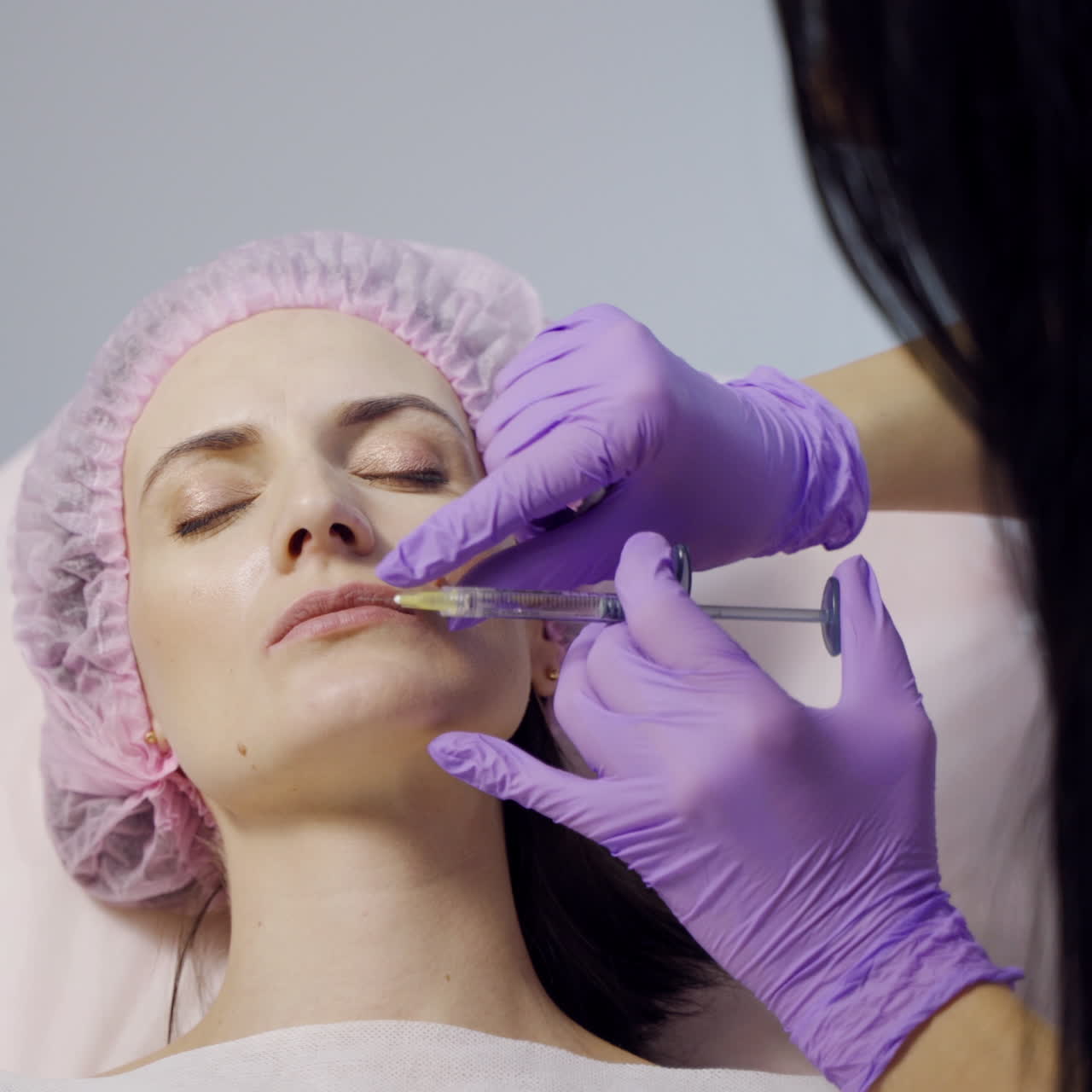 A client are laying with her eyes closed in the chair during a lip augmentation procedure. Botox. Beauty injections. Close-up.