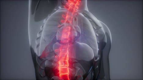 backache in back bones