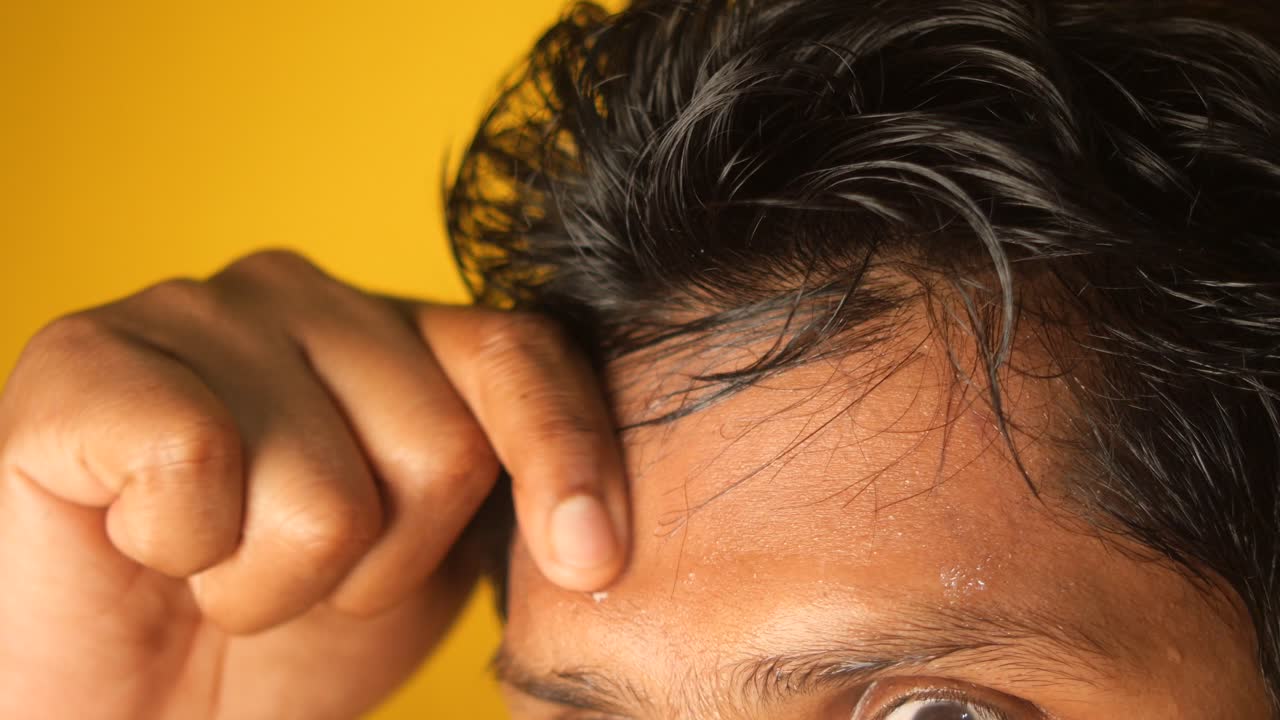 으로 가득 찬 남자의 이마