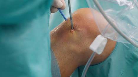 surgeon performing arthroscopic knee surgery - close-up