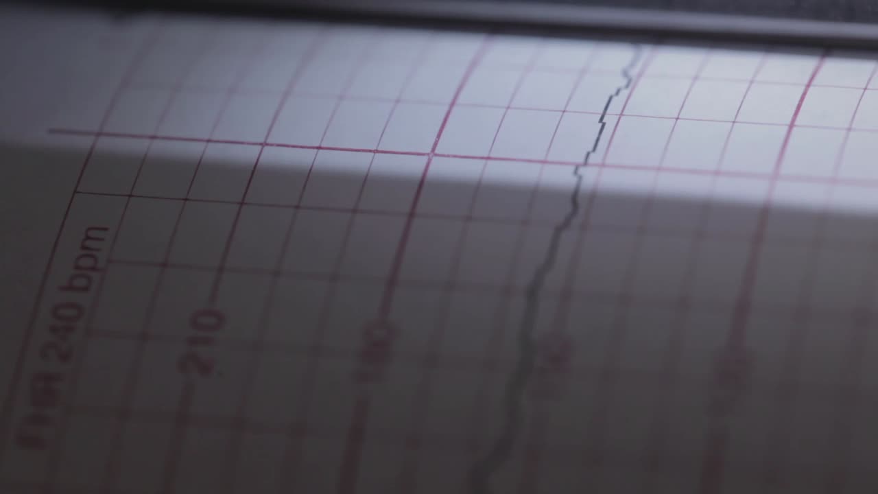 Close up of a heart monitor paper taking readings on a baby inside of a pregnant ladies belly