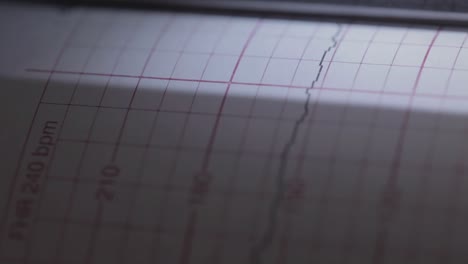 primer plano de un papel de monitor cardíaco tomando lecturas en un bebé dentro del vientre de una mujer embarazada