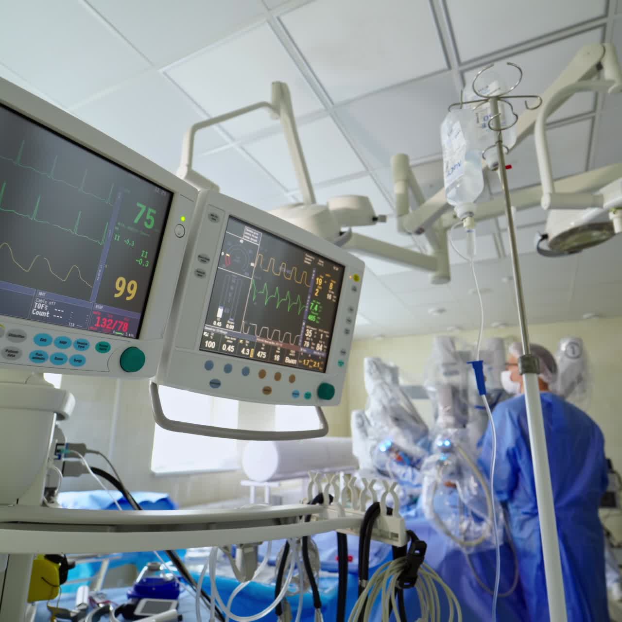 Attrezzature mediche in sala operatoria. Monitor che mostrano i segni vitali di un paziente sullo sfondo di un processo chirurgico con sistema robotico.