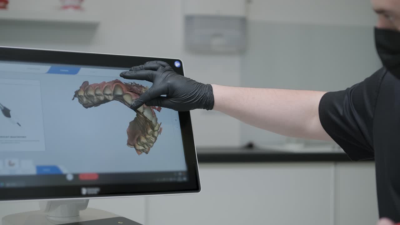 el médico escanea los dientes del paciente en la clínica. el dentista sostiene en su mano un escáner 3d manual para la mandíbula y la boca. salud dental. crea un modelo 3d de dientes y encías en un monitor médico.