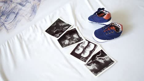 baby shoes and ultrasound photo. pregnancy concept