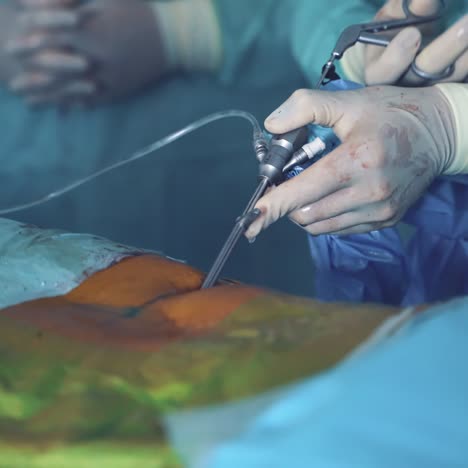 process of surgery operation